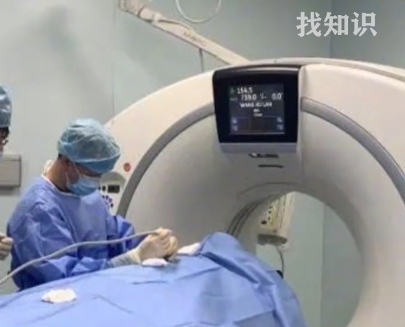 冷冻消融技术治疗肿瘤的原理