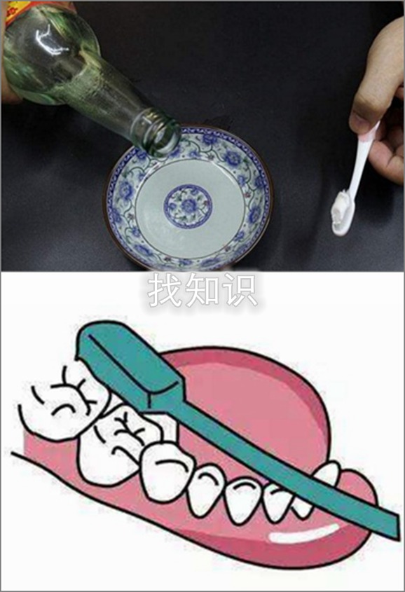 醋,漱口,牙痛,缓解