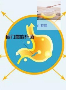茶油对幽门螺旋杆菌抑制效果的分析​